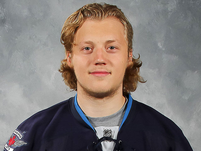 PHOTO: Jets' prospect Ryan Olsen shows off battle scars after rough day on the ice