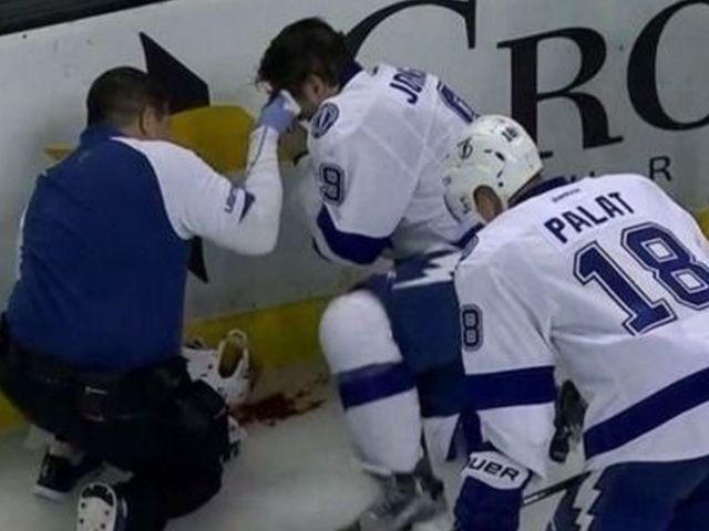 Lightning's Johnson expected to be OK after taking puck to head