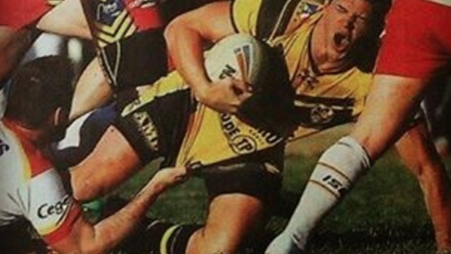 Rugby player's penis 'pretty much ripped off' during match