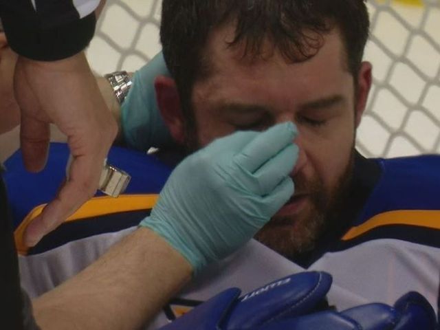 Slap shot to Elliott's mask knocks out contact lens