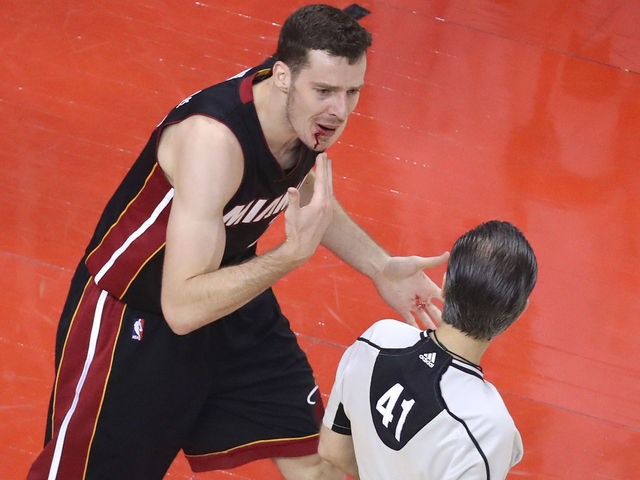 Dragic gets stitched up after taking elbow to face