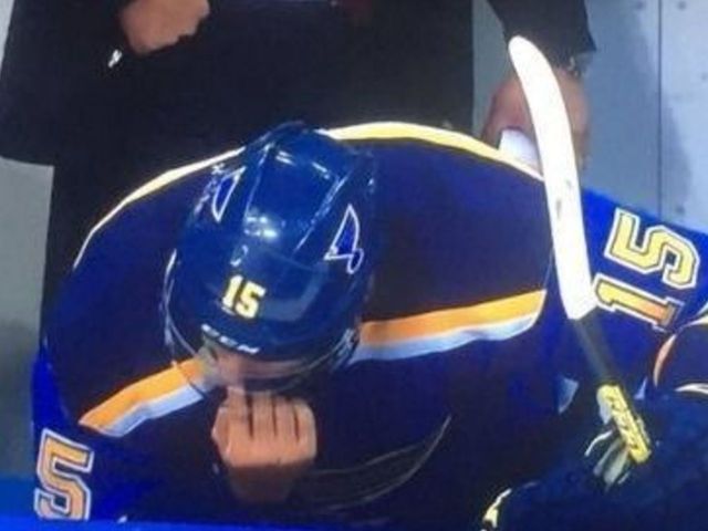 Blues' Fabbri shares unflattering nose pic from Game 1