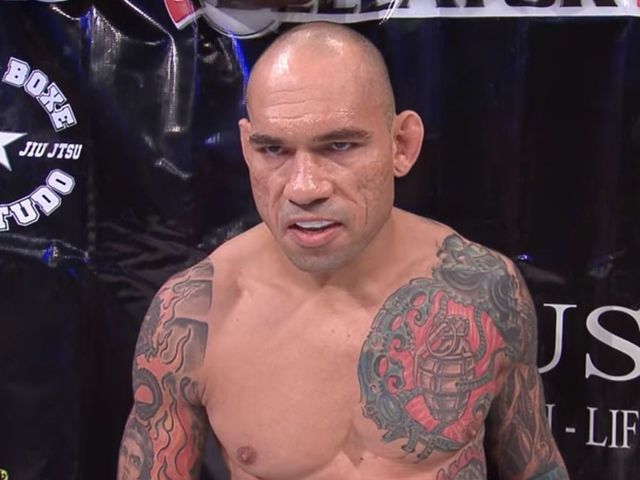 'Cyborg' Santos undergoes successful surgery on fractured skull