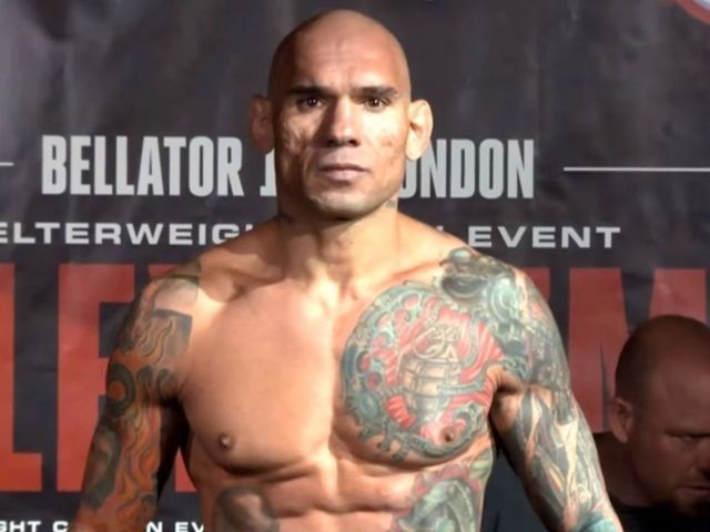 'Cyborg' Santos shares photos of fixed skull post-surgery