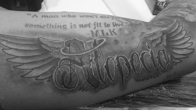 Villanueva gets tattoo in solidarity with those affected by alopecia