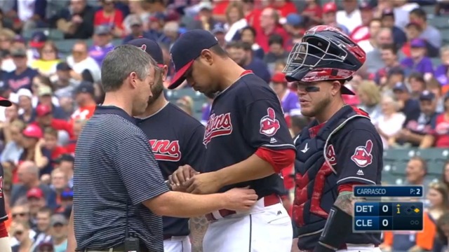 Indians' Carrasco exits after taking line drive off hand