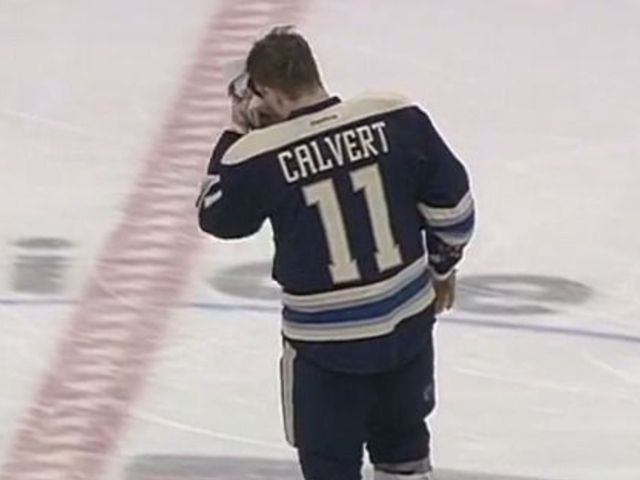 Calvert gets 36 stitches in face, returns to score game-winner