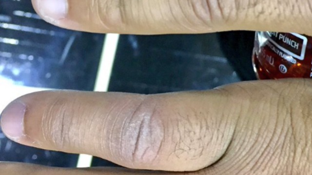 Look: Chriss' pinky a tad swollen after kick from Draymond