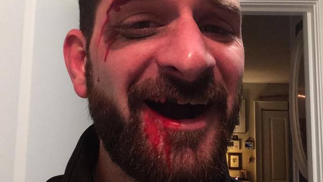 Fan loses tooth while trying to find Tom Brady's old UGGs