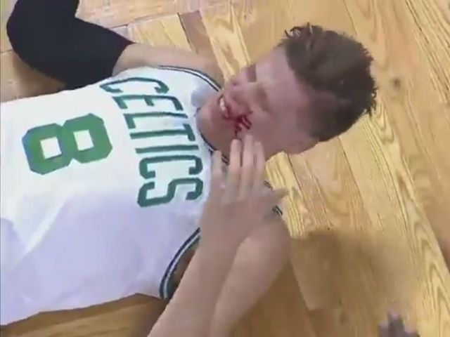 Harden picks up flagrant foul for blood-drawing hit on Jerebko