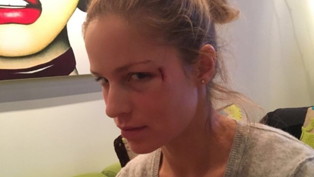 Gaborik's girlfriend struck by puck at Kings game