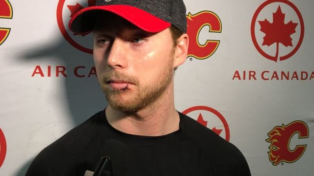 Flames' Bennett needed root canal, stitches after taking high stick