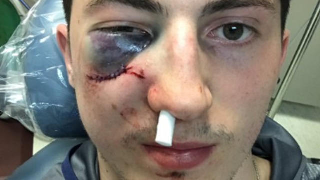 Werenski shares gruesome selfie after taking shot to face