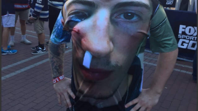 Columbus fan's shirt features Werenski's beat-up face