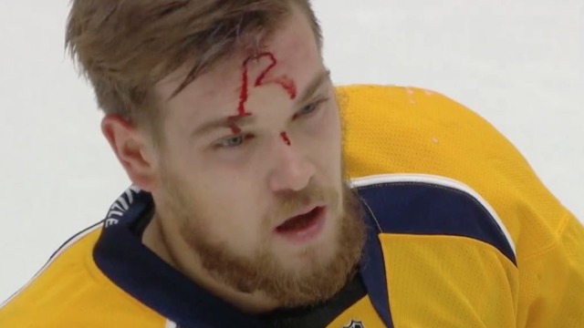 Twitter tries to decipher Arvidsson's 'R'-shaped blood stain