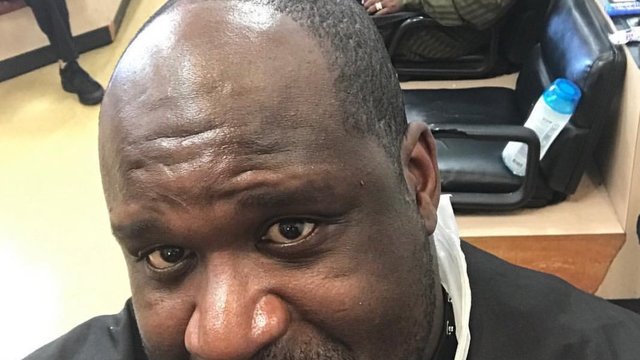 Battle of receding NBA hairlines continues with Shaq headlining