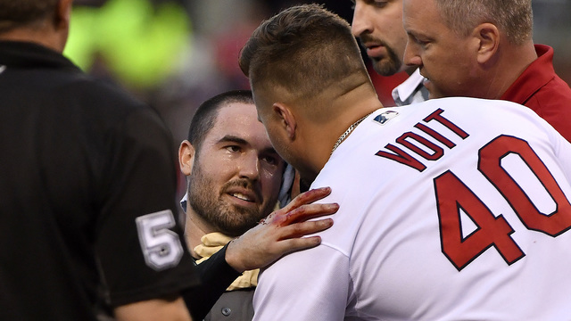 D-Backs to place Ray in concussion protocol after line drive to head