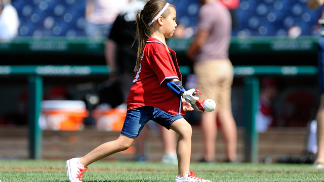 Girl with 3D-printed hand to throw out 1st pitch at Game 4 of WS