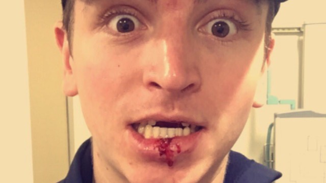Vesey shares bloody lip pic, unusual X-ray after taking skate to mouth