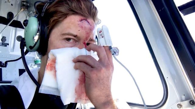 Shaun White shares footage of crash that led to in 62 stitches in face
