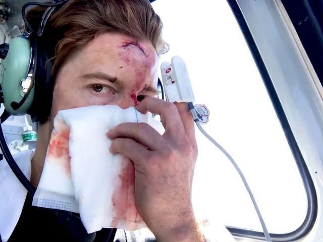 Shaun White on competing again after horrific crash: 'I was a bit terrified