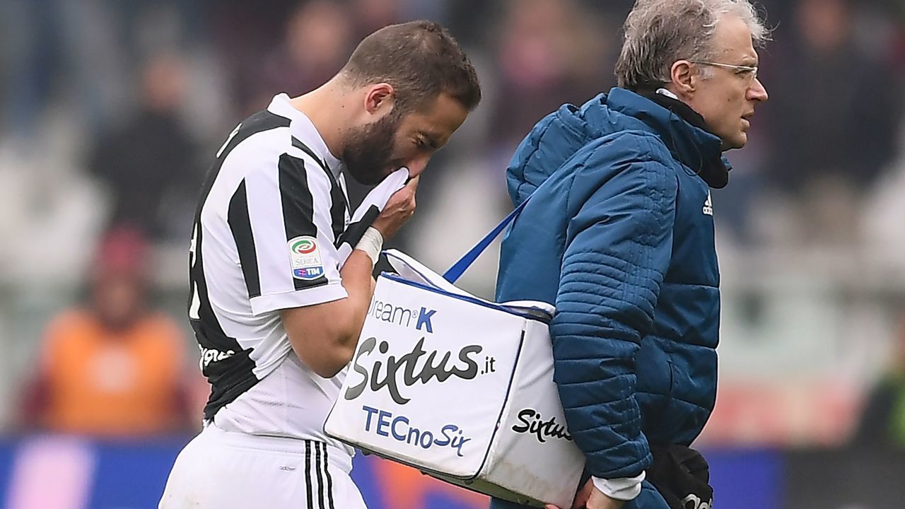 Juventus' Argentinian forward Gonzalo Higuain (L) reacts during the Italian Serie A football match Torino vs Juventus on February 18, 2018 at the stadio Grande Torino stadium in Turin. / AFP PHOTO / MARCO BERTORELLO