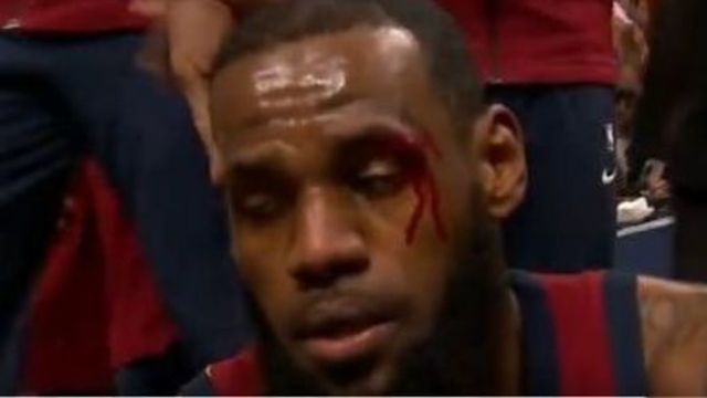 Watch: LeBron bloodied from inadvertent elbow to the face