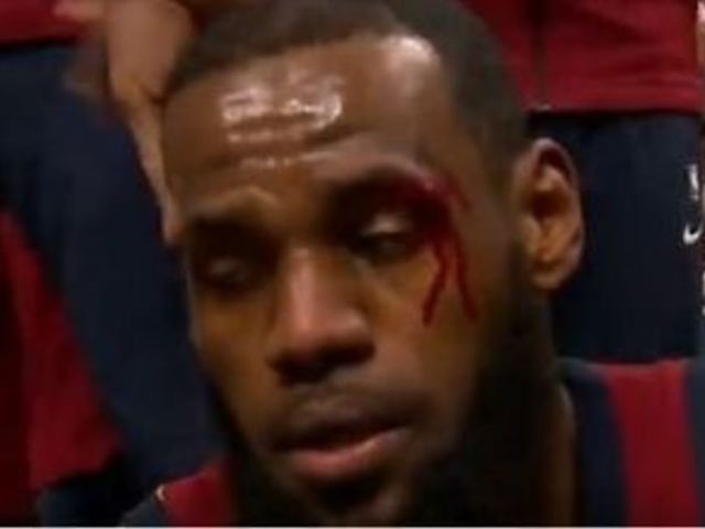 Watch: LeBron bloodied from inadvertent elbow to the face