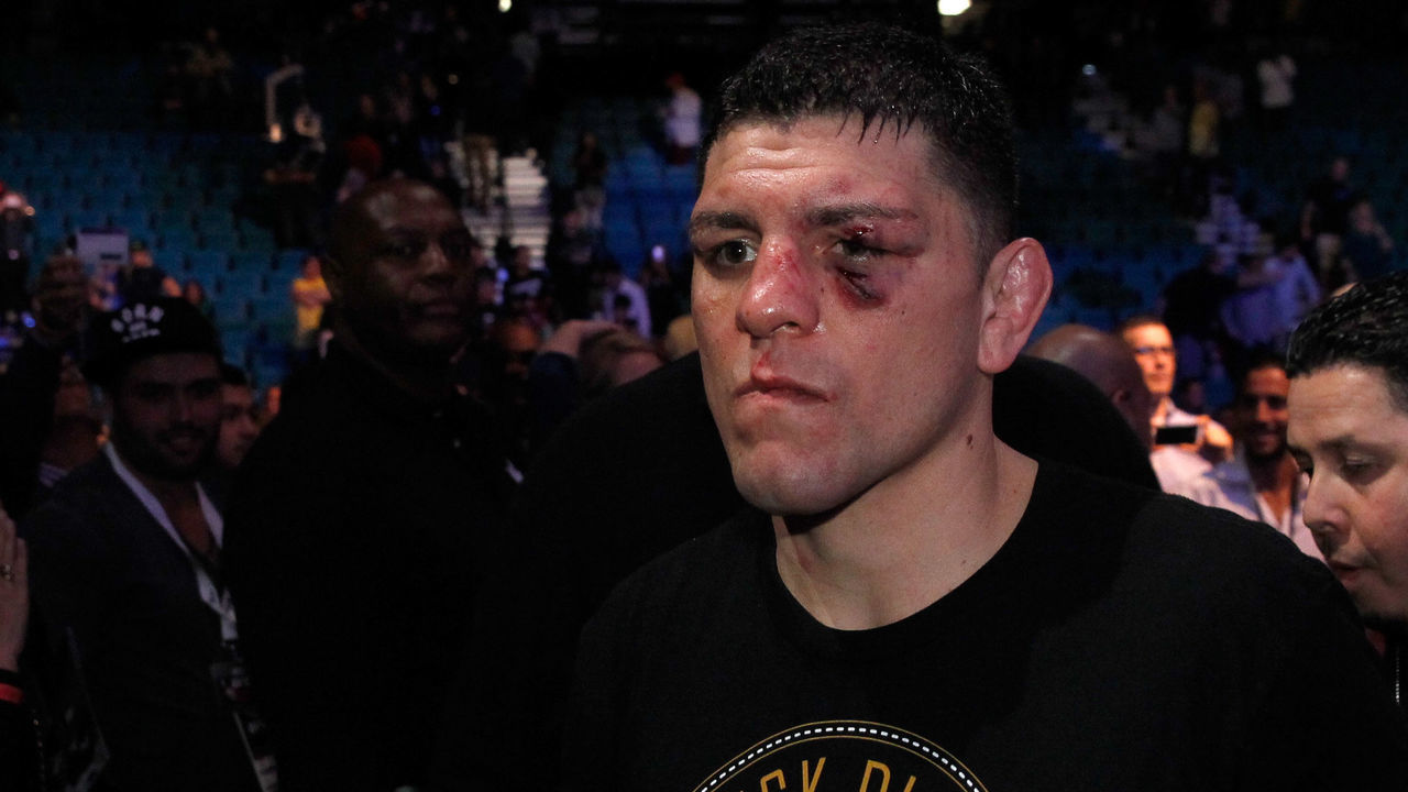 LAS VEGAS, NV - JANUARY 31: Nick Diaz leaves the arena after losing to Anderson Silva in a middleweight bout during UFC 183 at the MGM Grand Garden Arena on January 31, 2015 in Las Vegas, Nevada. Silva won by unanimous decision.