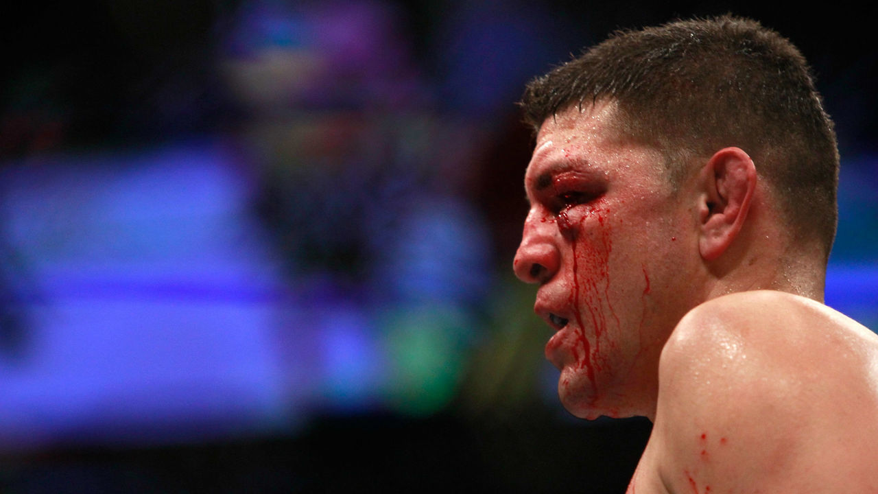 LAS VEGAS, NV - JANUARY 31: Nick Diaz stands in the Octagon after taking a hit from Anderson Silva in a middleweight bout against Anderson Silva during UFC 183 at the MGM Grand Garden Arena on January 31, 2015 in Las Vegas, Nevada. Silva won by unanimous decision.