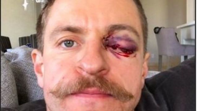 Coyotes' Grabner out indefinitely after suffering gruesome eye injury