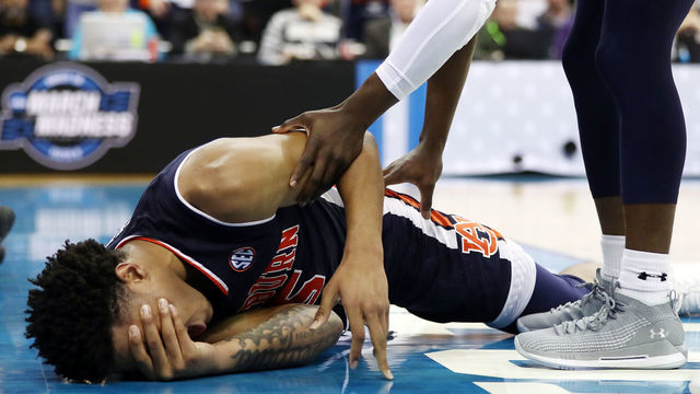 KANSAS CITY, MISSOURI - MARCH 29: Chuma Okeke #5 of the Auburn Tigers reacts after suffering an injury against the North Carolina Tar Heels during the 2019 NCAA Basketball Tournament Midwest Regional at Sprint Center on March 29, 2019 in Kansas City, Missouri.