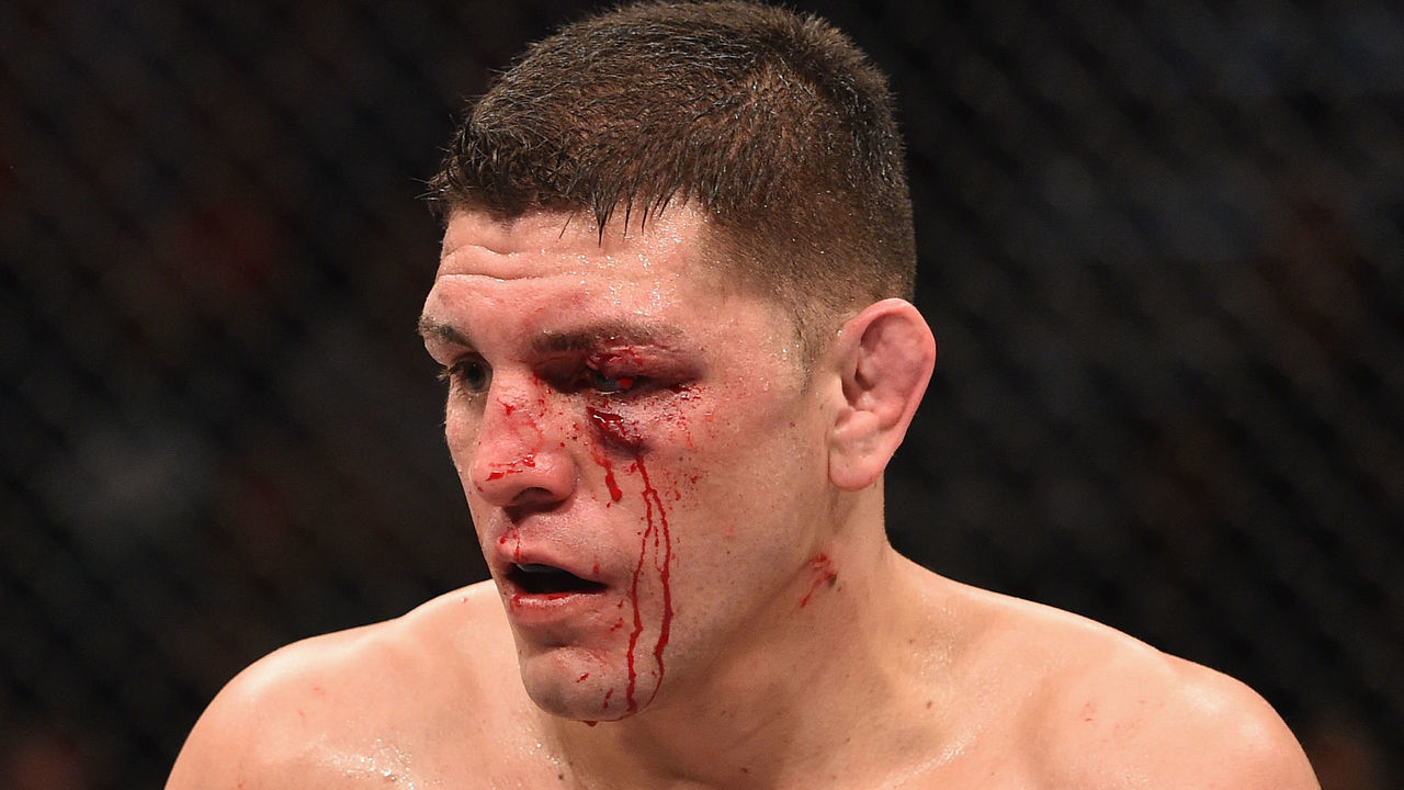 LAS VEGAS, NV - JANUARY 31: Nick Diaz battles Anderson Silva (not pictured) in their middleweight bout during the UFC 183 event at the MGM Grand Garden Arena on January 31, 2015 in Las Vegas, Nevada.