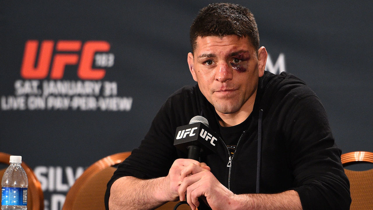 LAS VEGAS, NV - JANUARY 31: Nick Diaz interacts with the media during the UFC 183 post fight press conference at the MGM Grand Garden Arena on January 31, 2015 in Las Vegas, Nevada.