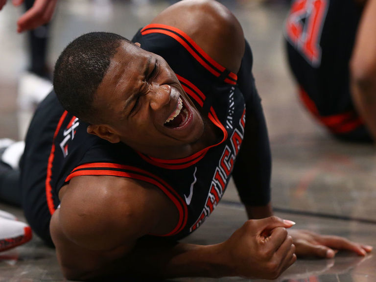 Bulls' Dunn out for season