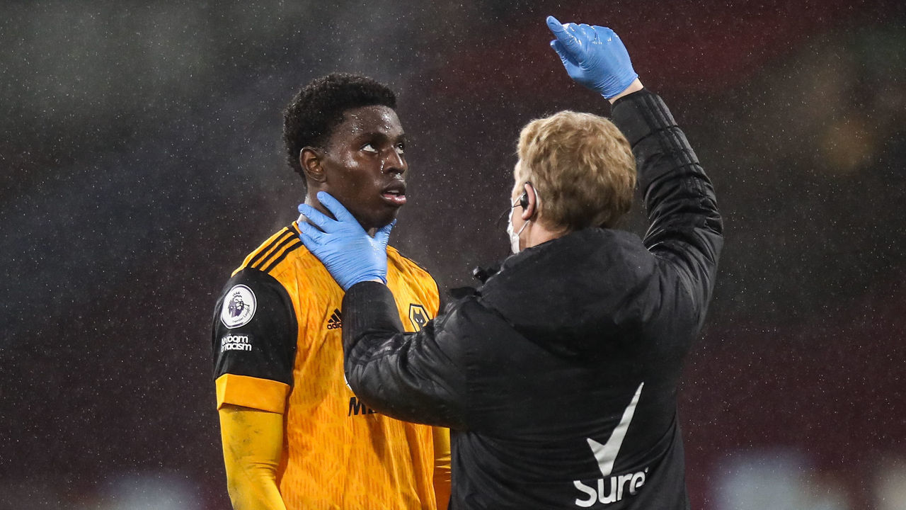 BURNLEY, ENGLAND - DECEMBER 21: Owen Otasowie of Wolverhampton Wanderers receives treatment for a head injury testing for possible concussion during the Premier League match between Burnley and Wolverhampton Wanderers at Turf Moor on December 21, 2020 in Burnley, United Kingdom.