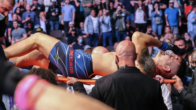 JACKSONVILLE, FL - APRIL 24: Chris Weidman of the United States leaves the fight on a stretcher after breaking his leg on a kick attempt to Uriah Hall of Jamaica during UFC 261 at VyStar Veterans Memorial Arena on April 24, 2021 in Jacksonville, Florida.
