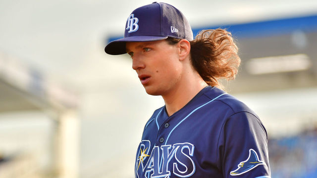 DUNEDIN, FLORIDA - MAY 21: Tyler Glasnow #20 of the Tampa Bay Rays looks on before a game against the Toronto Blue Jays at TD Ballpark on May 21, 2021 in Dunedin, Florida.