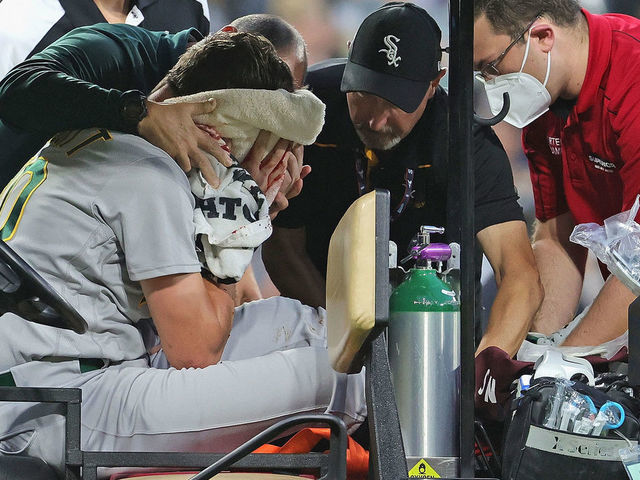 CHICAGO, ILLINOIS - AUGUST 17: Starting pitcher Chris Bassitt #40 of the Oakland Athletics is placed on a cart after being hit in the head by a line drive from Brian Goodwin of the Chicago White Sox in the second inning at Guaranteed Rate Field on August 17, 2021 in Chicago, Illinois.