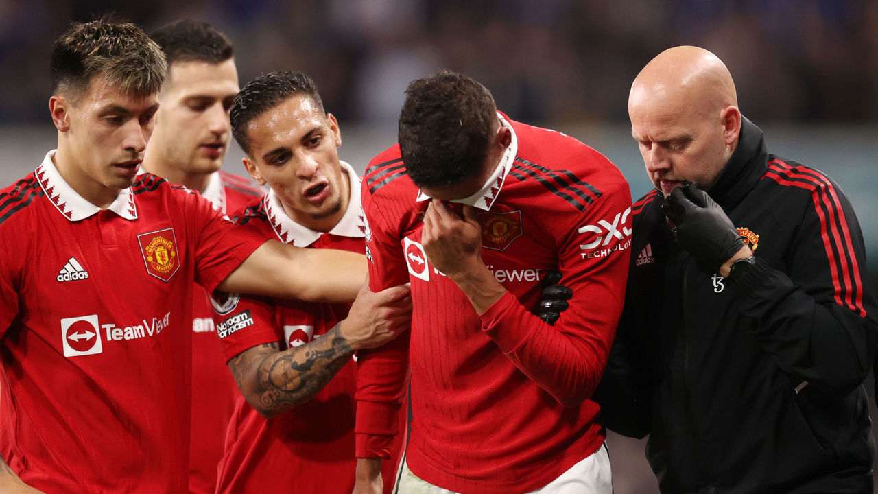 LONDON, ENGLAND - OCTOBER 22: Raphael Varane of Manchester United shows emotion as he leaves the pitch with an injury during the Premier League match between Chelsea FC and Manchester United at Stamford Bridge on October 22, 2022 in London, England.