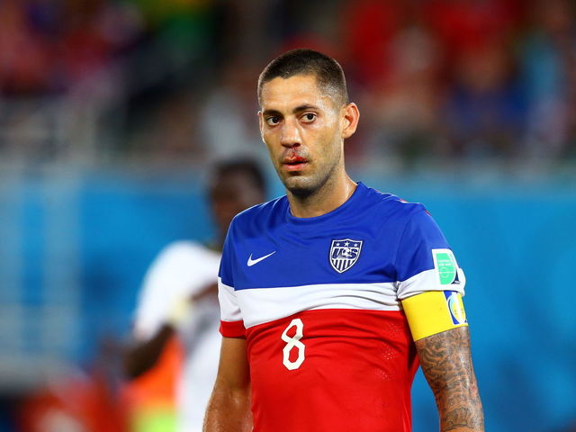 U.S. player Clint Dempsey a go for Sunday despite broken nose