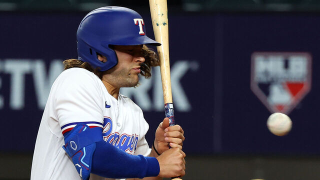 ARLINGTON, TEXAS - APRIL 03: An open cut is seen on the cheek of Josh Smith #47 of the Texas Rangers after being hit by a pitch from Danny Coulombe of the Baltimore Orioles in the third inning at Globe Life Field on April 03, 2023 in Arlington, Texas.