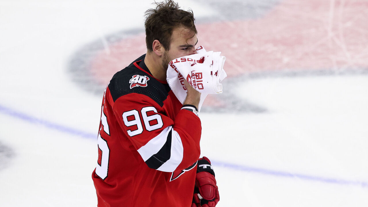 NEWARK, NJ - MAY 01: New Jersey Devils right wing Timo Meier (96) holds a towel to his face after getting hit during Game 7 of an Eastern Conference First Round playoff game between the New York Rangers and the New Jersey Devils on May 1, 2023, at Prudential Center in Newark, New Jersey.