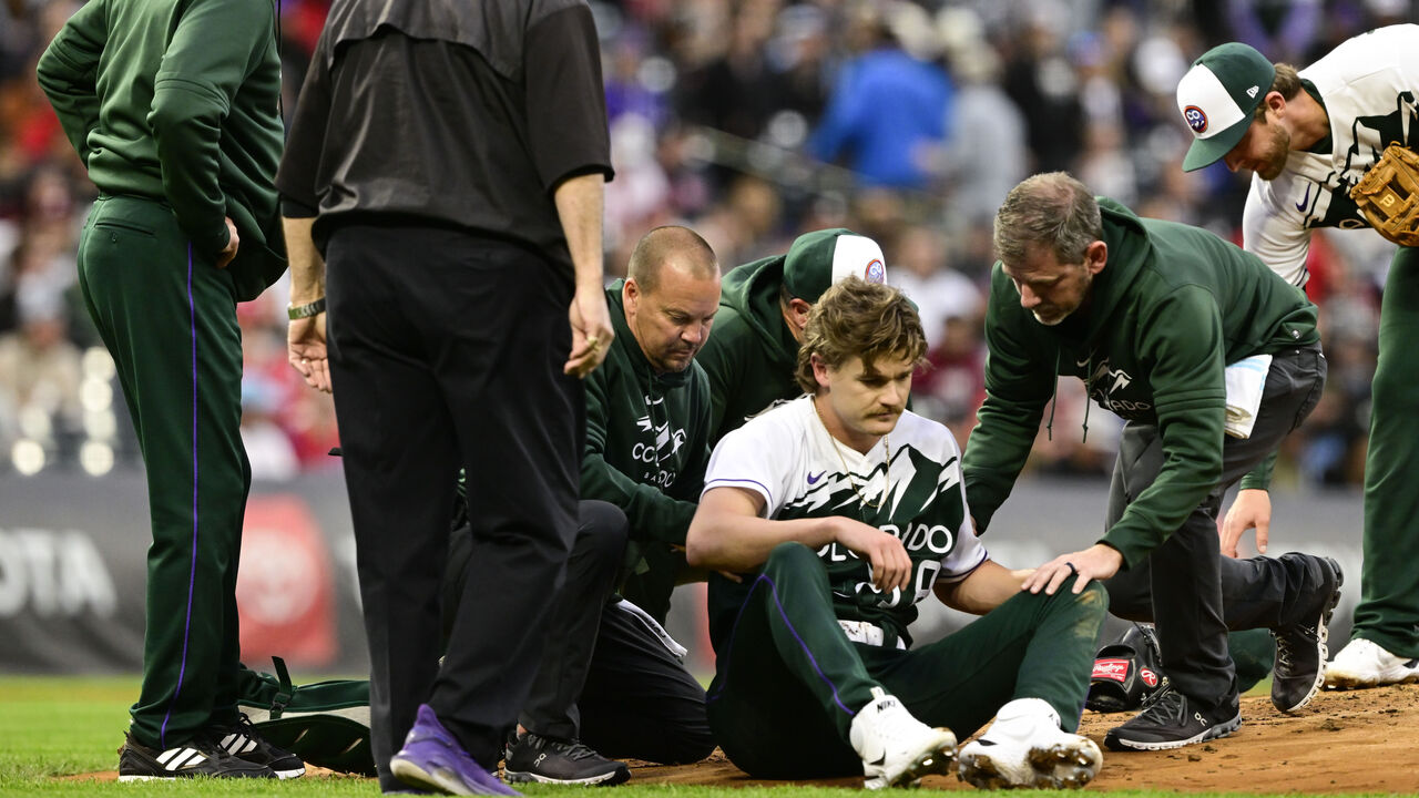 Rockies pitcher Feltner fractures skull after taking 93 mph line