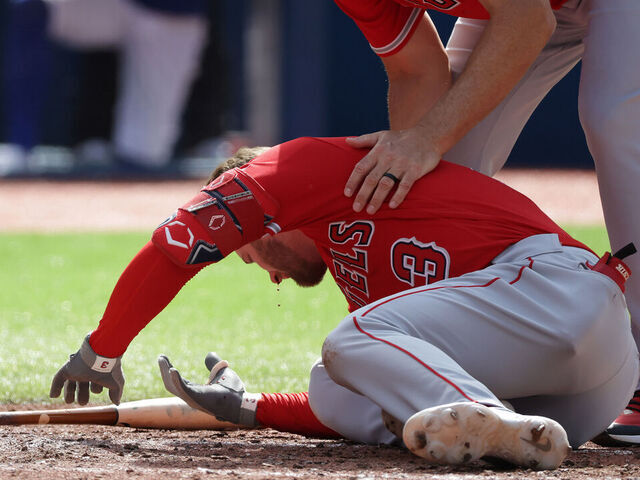 TORONTO, ON - JULY 29 - Los Angeles Angels third base coach Bill Haselman (82) checks on Los Angeles Angels left fielder Taylor Ward (3) after he is hit by a pitch as the Toronto Blue Jays play the Los Angeles Angels at Rogers Centre in Toronto. July 29, 2023. (Steve Russell/Toronto Star via Getty Images)