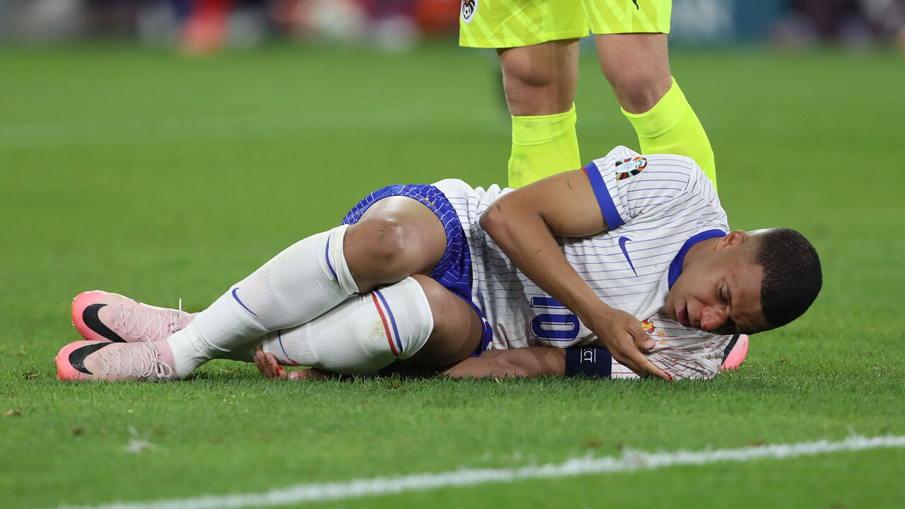 DUSSELDORF, GERMANY - JUNE 17: Kylian Mbappe of France injured on the ground during the UEFA EURO 2024 group stage match between Austria and France at Düsseldorf Arena on June 17, 2024 in Dusseldorf, Germany.