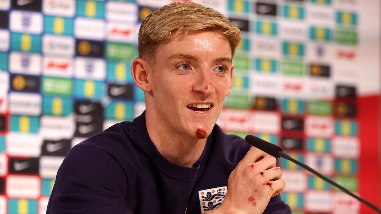 BLANKENHAIN, GERMANY - JUNE 28: Anthony Gordon of England speaks to the media during a press conference at Spa & Golf Resort Weimarer Land on June 28, 2024 in Blankenhain, Germany.