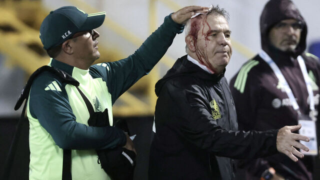 TOPSHOT - Mexico's coach, Javier Aguirre (R), is helped by an assistant after being injured in the head when he was hit by an object thrown from the bleachers at the end of the National League of Concacaf quarterfinal first leg match between Honduras and Mexico at the Francisco Morazan stadium in San Pedro Sula, Honduras, on November 15, 2024.