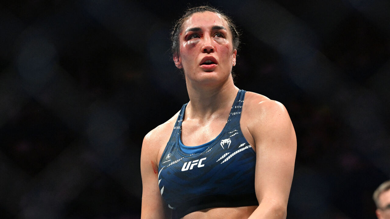 Tatiana Suarez of the US reacts after her defeat to China's Zhang Weili during their women's strawweight title bout of the Ultimate Fighting Championship (UFC) 312 at Qudos Bank Arena in Sydney on February 9, 2025.